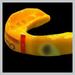 TWG Guard - Custom Mouthguard