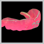 TWG Guard - Custom Mouthguard