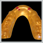 TWG Guard - Custom Mouthguard