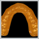 TWG Guard - Custom Mouthguard
