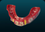 TWG - The WrightGUARD™ Mouth Guard