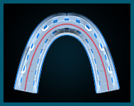 Ideal Arch Taper